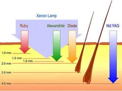 Pénétration lumière