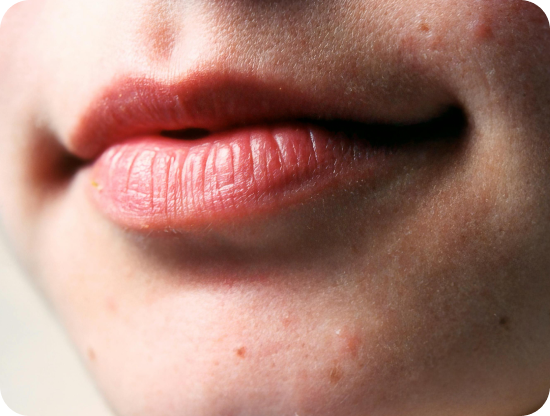 plan sur la lèvre supérieure d’une femme | NY Center