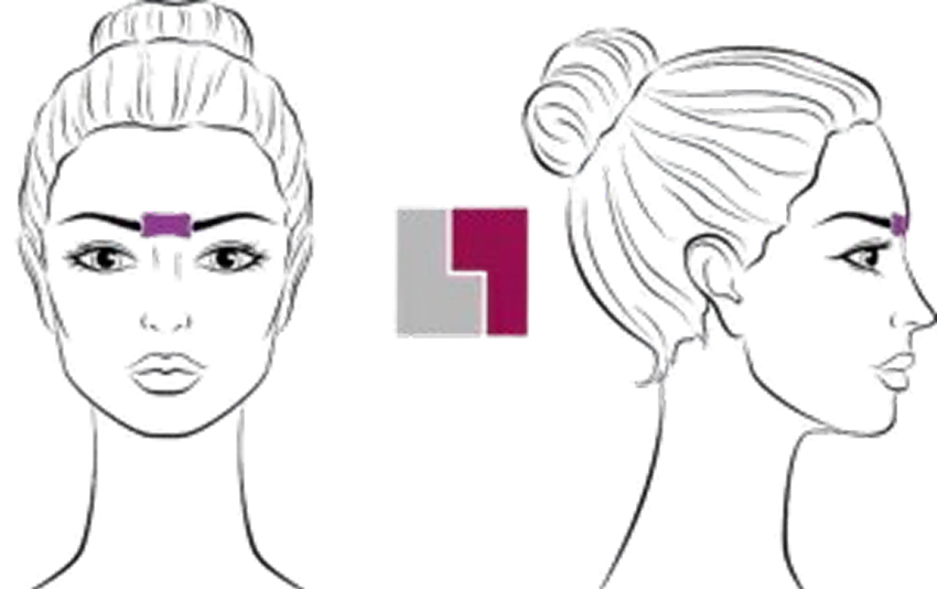 Épilation laser de la glabelle | NY Center