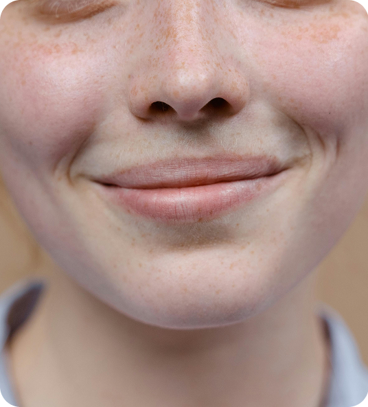 Gros plan sur la lèvre supérieure d’une femme | NY Center