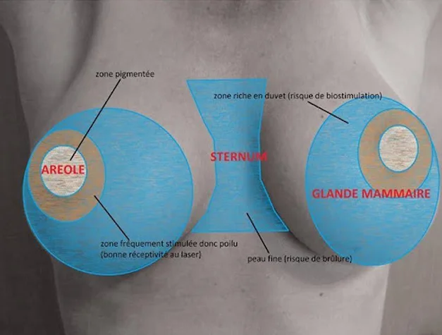 Aréole et zone mammaire | NY Center