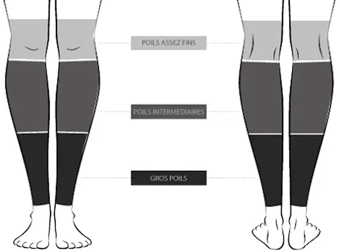 Schéma des zones de pilosité haut et bas de jambe pour traitement laser | NY Center