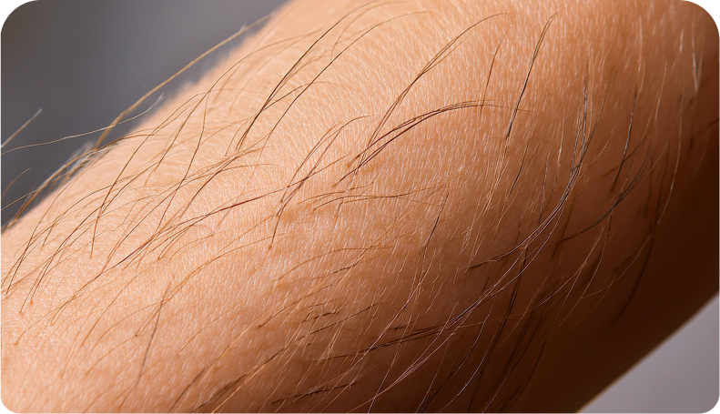Poils fins sur le bras | NY Center