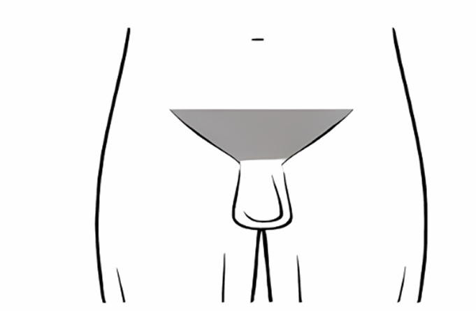 Schema zone intime masculine pour traitement