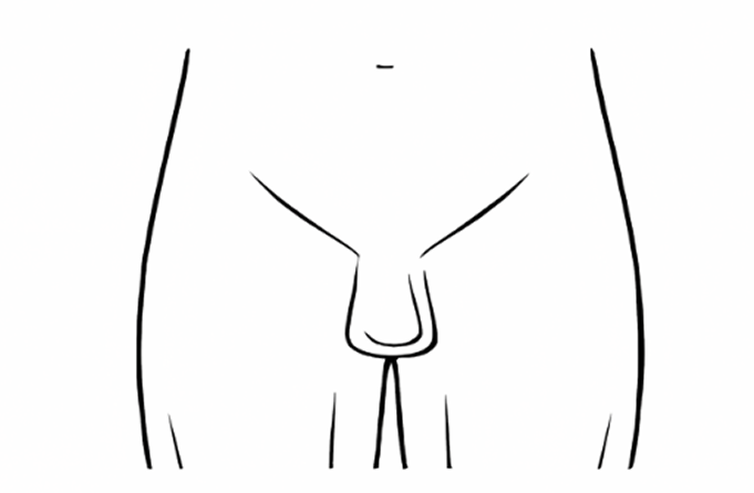 Schema zone intime masculine pour traitement