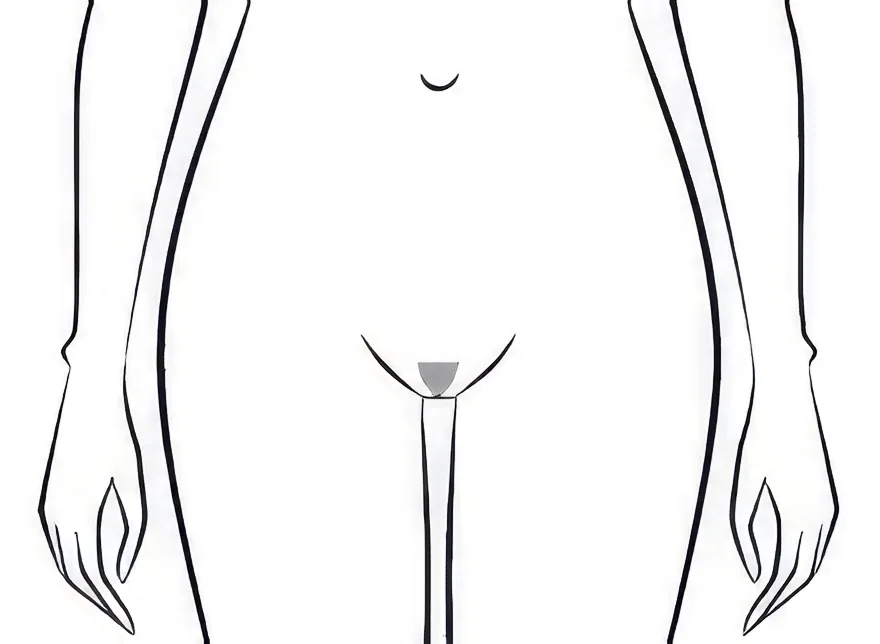 Schéma épilation maillot style américain femme