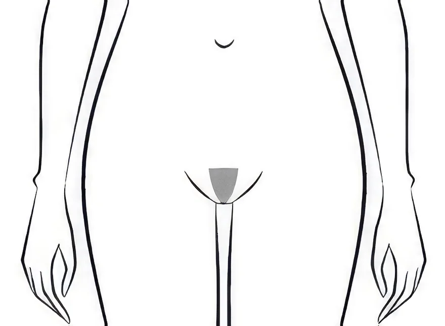 Schéma épilation maillot style brésilien femme