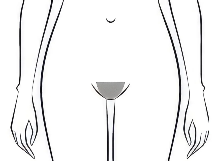 Schéma épilation maillot style bikini femme