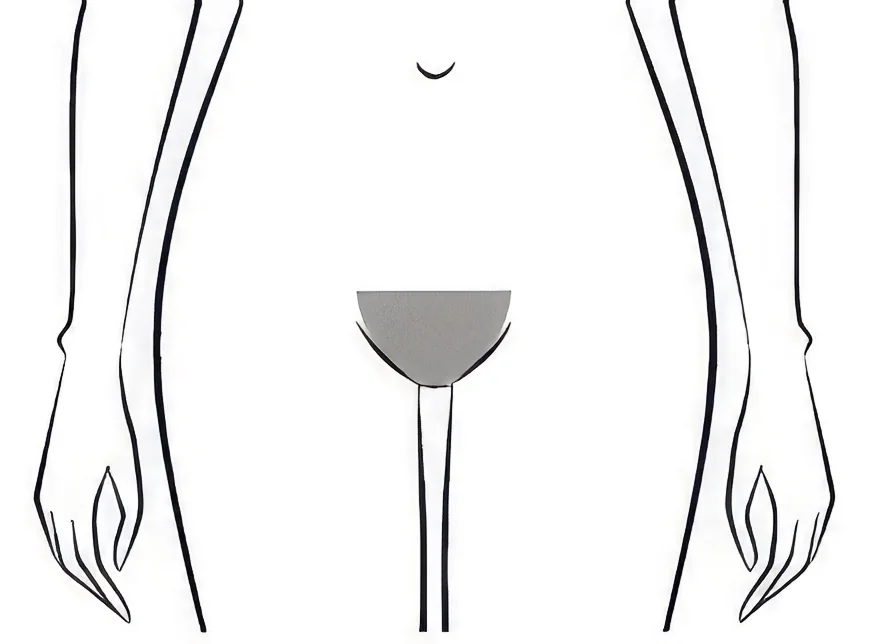 Schéma épilation maillot classique femme