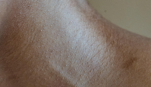 Peau du cou en gros plan | NY Center