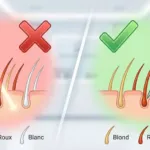 Poils blonds, roux et blancs : limites de l’épilation laser et place de l’électrolyse au NY Center à Rouen