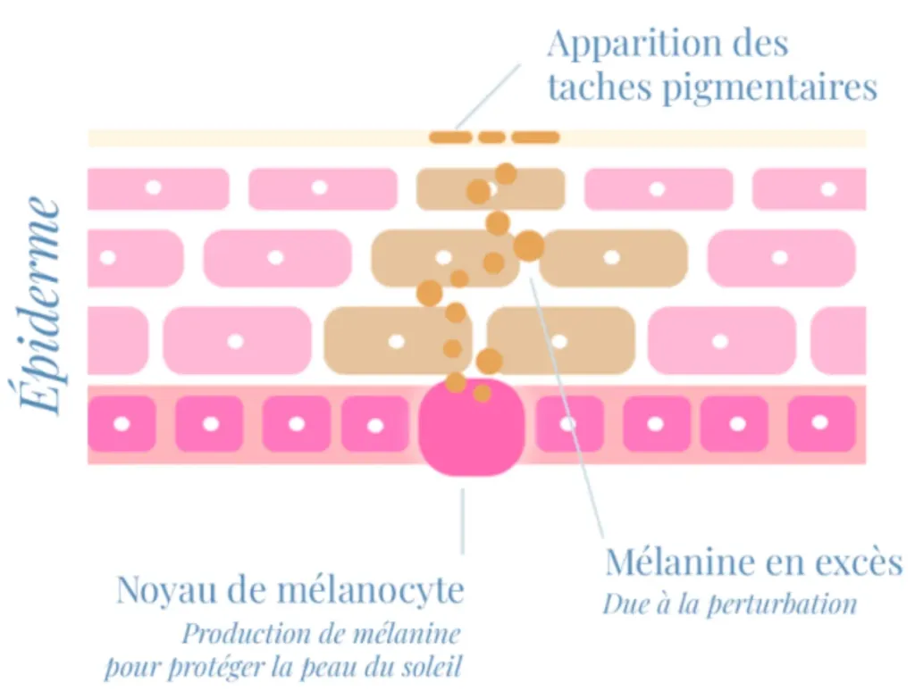 Schema formation des taches pigmentaires