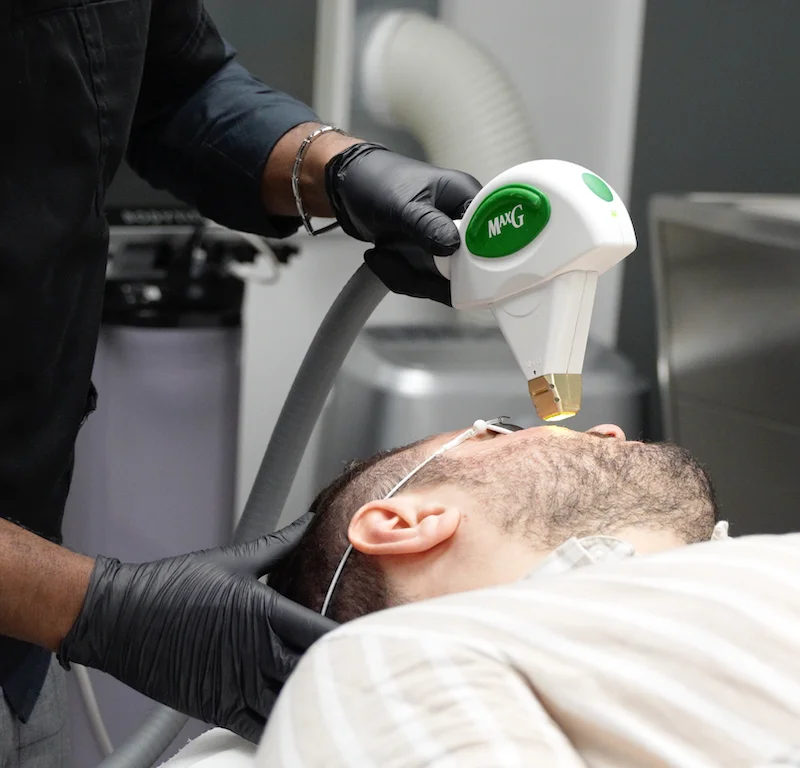 Traitement laser des taches pigmentaires du visage | NY Center