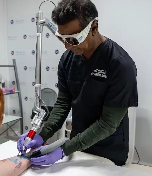 enlever tatouage dieppe