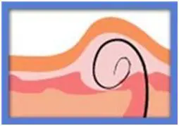 Schéma d'un poil sous peau