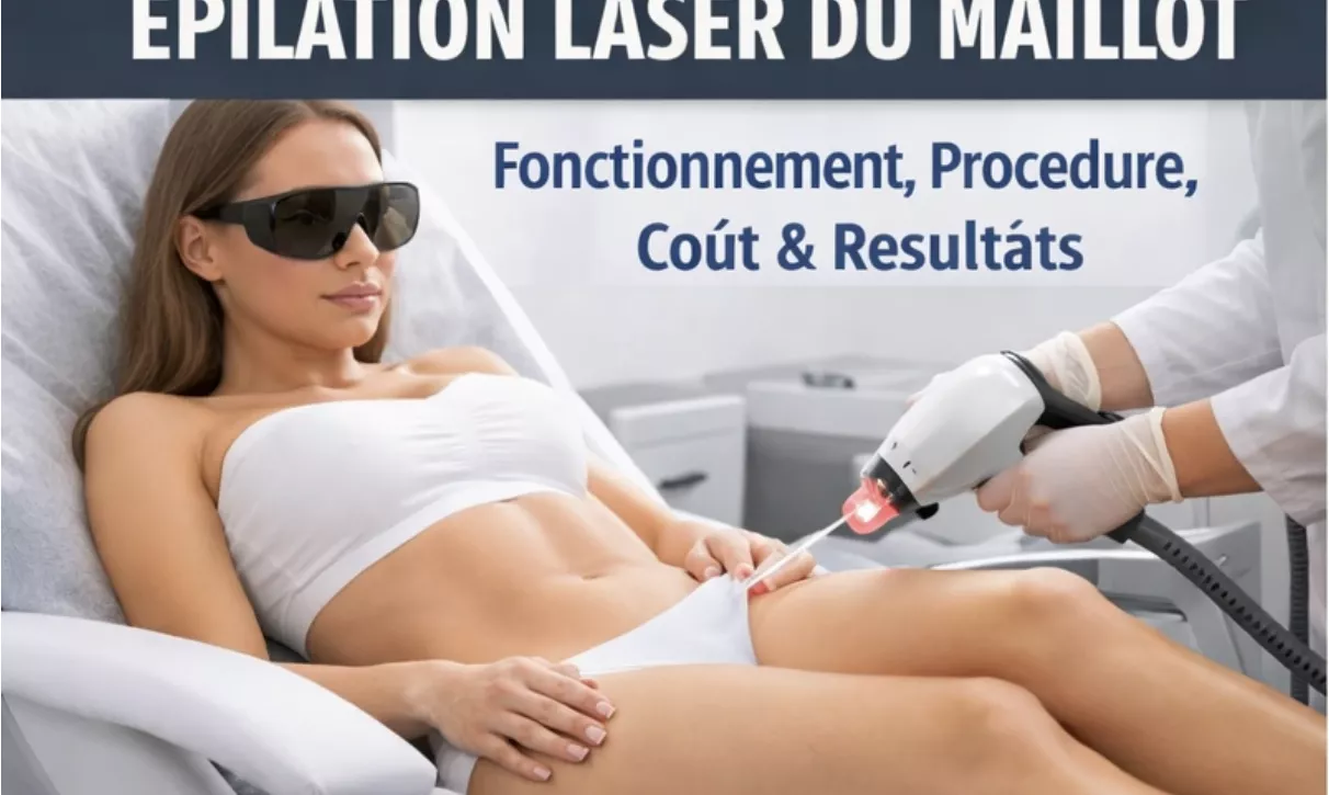 Épilation Laser Maillot : Fonctionnement, Procédure, Coût et Résultats Expliqués (Guide 2026)
