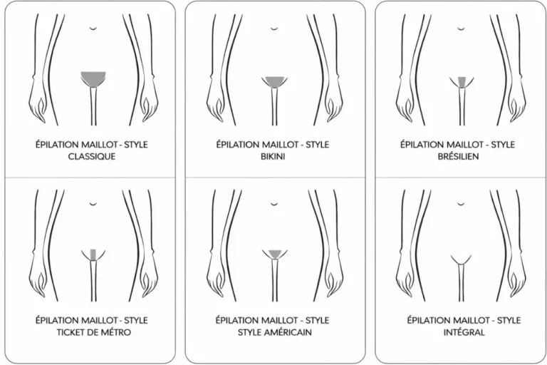 Schéma des types de maillot (classique, échancré, brésilien, intégral) – zones traitées