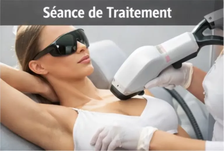 Séance d’épilation laser médicale des aisselles avec lunettes de protection