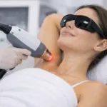 Qu’est-ce que l’épilation laser : fonctionnement, procédure, avantages, coût et résultats (Guide 2026)