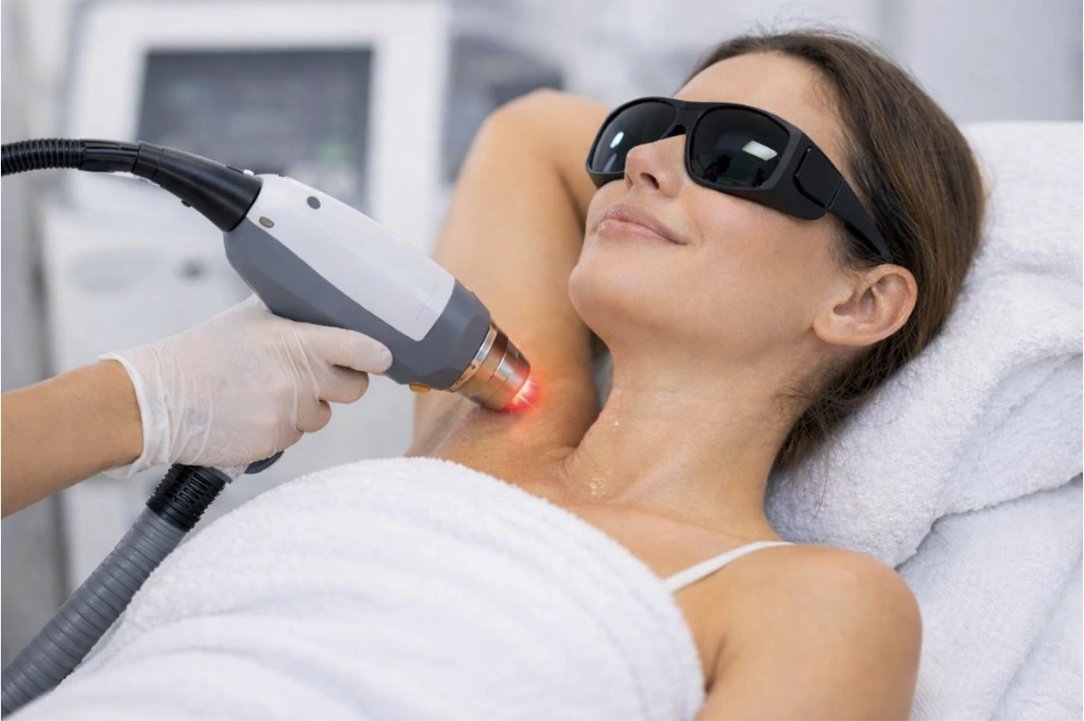 Qu’est-ce que l’épilation laser : fonctionnement, procédure, avantages, coût et résultats (Guide 2026)